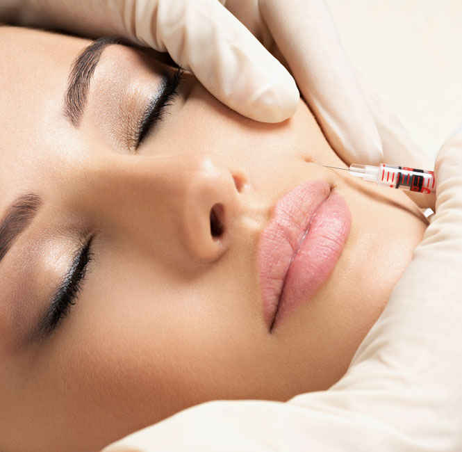 young model receiving a dermal filler by her lips